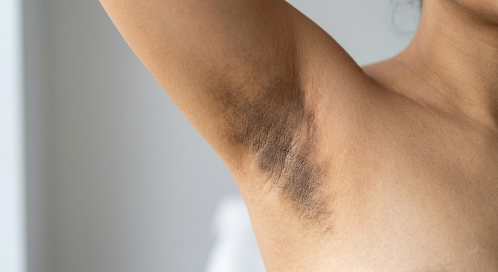 Underarm skin showing dark spots and hyperpigmentation before using Diya Balance brightening treatment.